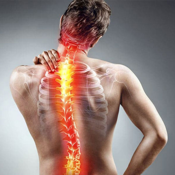 الجنف ( Scliosis)